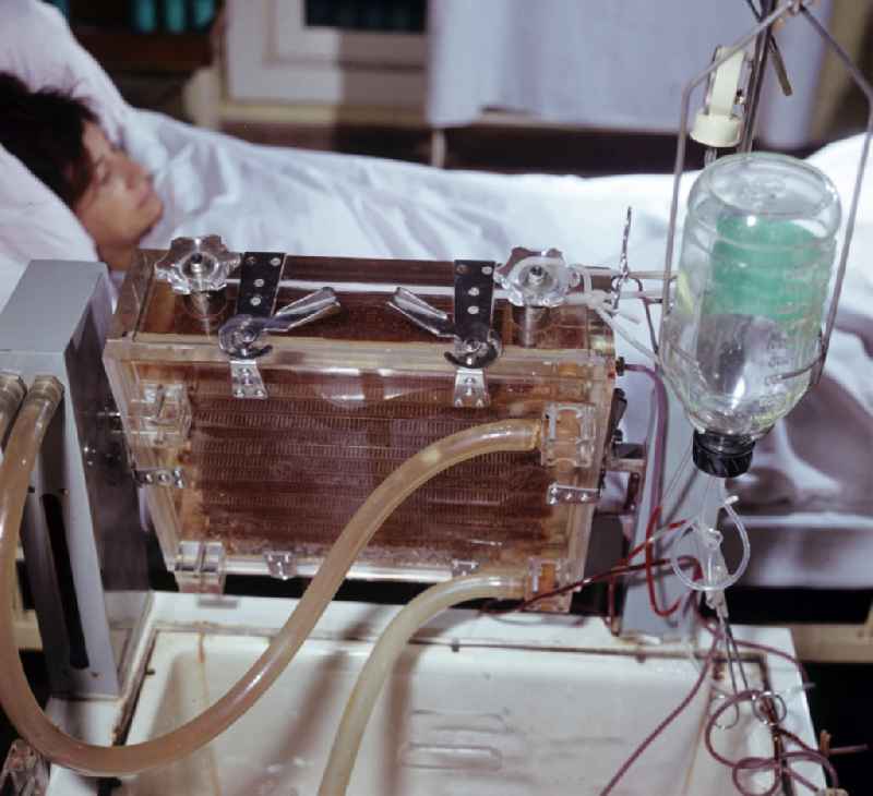 Patient care for dialysis with the help of 'artificial kidneys' in clinical operations in an intensive care unit of the Friedrichshain Hospital on Landsberger Allee (Leninallee) in the Friedrichshain district of East Berlin in the territory of the former GDR, German Democratic Republic